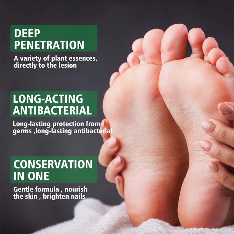 اسپری گیاهی ضدبو و درمان زخم پا حجم 30 میلی لیتر